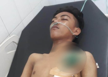 Sugiarto Pembengo, remaja 16 tahun yang berdomisili di Kelurahan Ipilo, Kota Gorontao, dengan senjata tajam jenis panah wayer yang masih menancap di dada sebelah kiri.