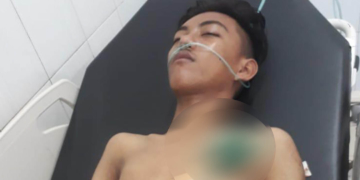 Sugiarto Pembengo, remaja 16 tahun yang berdomisili di Kelurahan Ipilo, Kota Gorontao, dengan senjata tajam jenis panah wayer yang masih menancap di dada sebelah kiri.