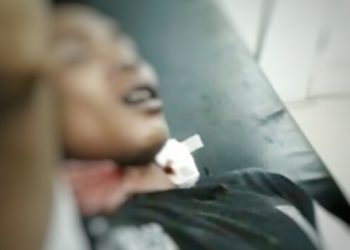 Korban penyerangan menggunakan panah wayer.