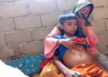 Yakop Molamahu (12), warga kecamatan Bulango Ulu, Kabupaten Bone Bolango yang berdasarkan diagnosa medis menderita tumor abdomen sejak 2 tahun terakhir.