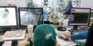 Petugas medis memantau jalannya prosedur kateterisasi jantung anak melalui layar monitor di ruang cath lab RSUD dr Aloei Saboe, Sabtu (18/4/2026). Tindakan minimal invasif ini menjadi yang pertama dilakukan di Gorontalo untuk menangani kelainan jantung bawaan pada anak. Foto Lukman¬ mimoza.tv